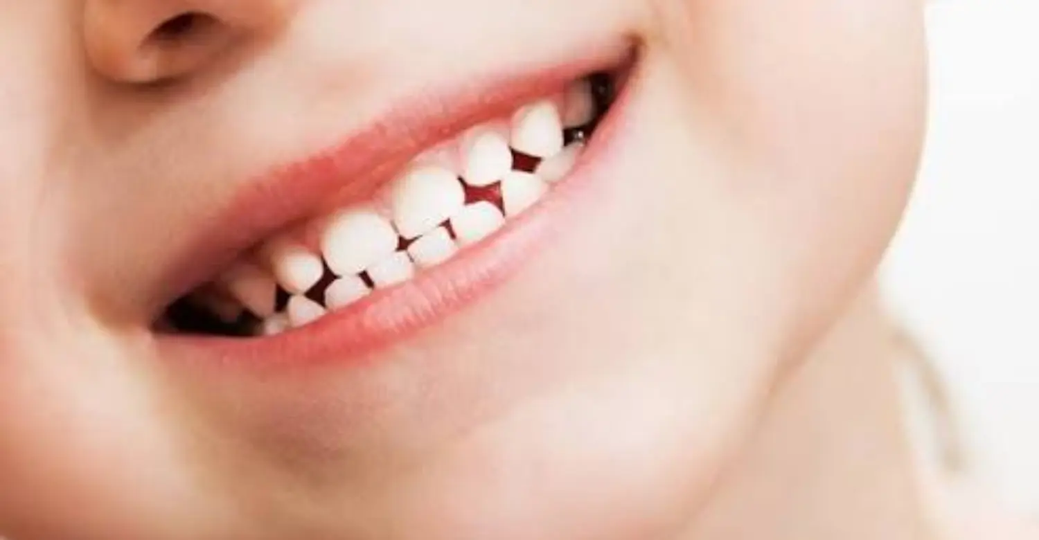 how many teeth do children have 2
